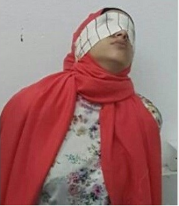 قبها1