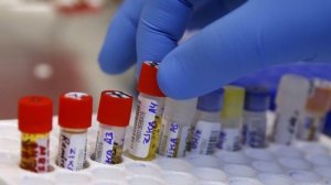 تسجيل اصابتين بفيروس الزيكا في إسرائيل