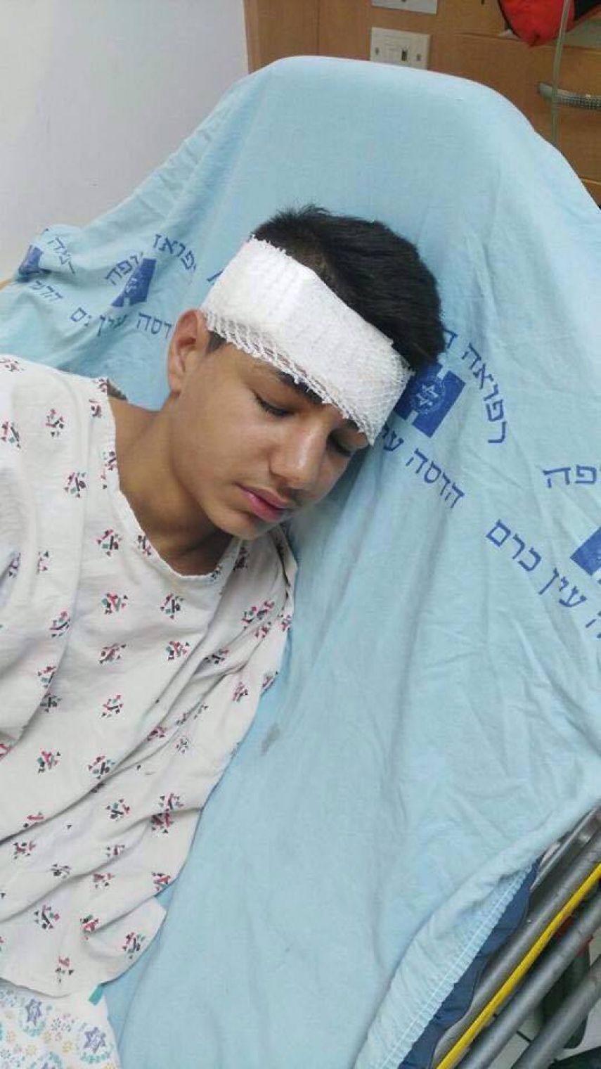 رصاص الاحتلال العشوائي يصيب فتى بكسور ونزيف بالجمجمة