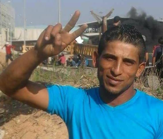 شهيد في غزة متأثرا بجراحة والحصيلة 20