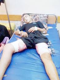 الشؤون المدنية: الموافقة على نقل الجريح القطراوي من غزة للعلاج بمستشفيات الضفة