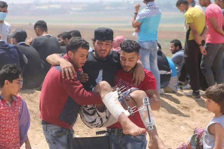 مُحدث: سبعة شهداء ومئات الاصابات بإشتداد المواجهات في غزة