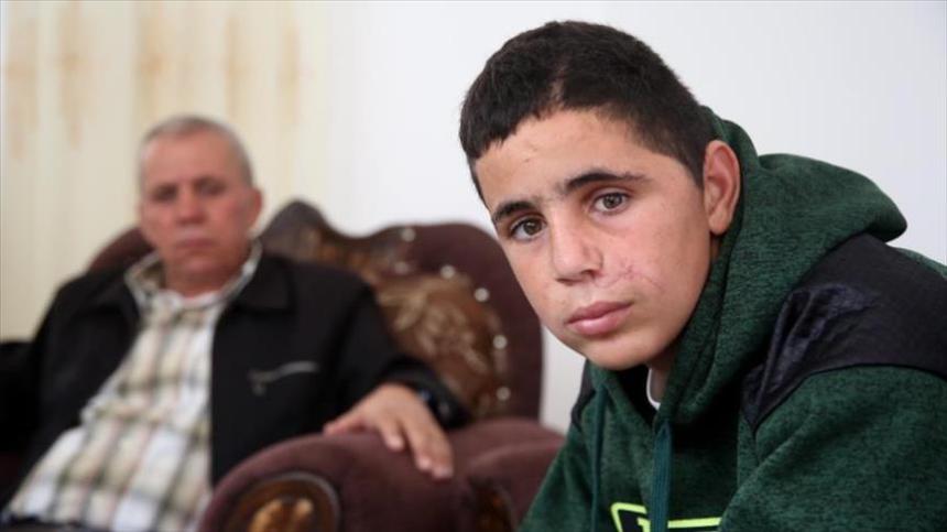 الاحتلال يفرج عن طفل جريح بعد اعتقاله لعدة ساعات