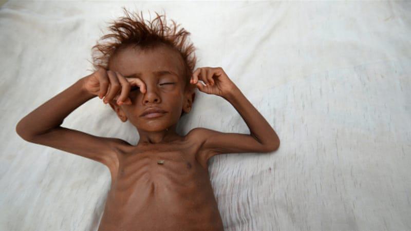 استمرار حرب اليمن يهدد بأسوأ مجاعة منذ 100 عام