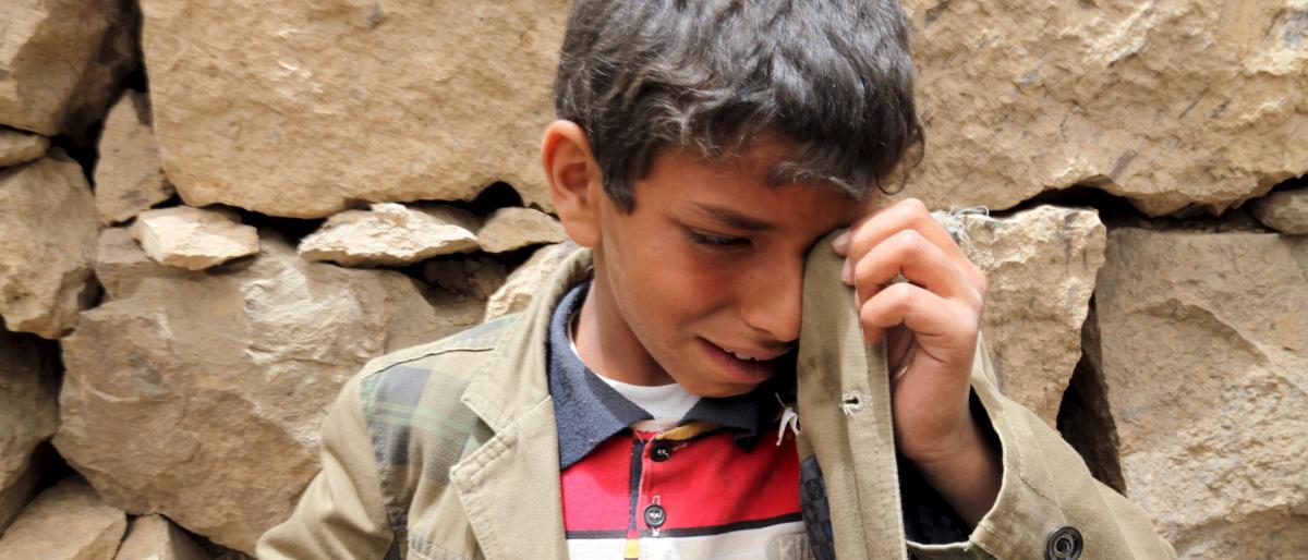 منظمة بريطانية تقدر وفاة 85 ألف طفل يمني بسبب سوء التغذية