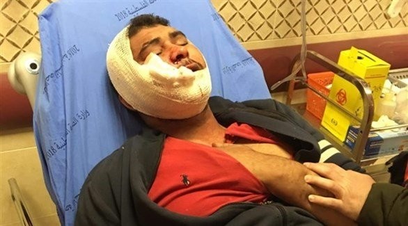 اصابة صحفي ومسعف خلال اقتحام المستوطنين لقبر يوسف