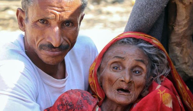 غوتيريش: 10 ملايين يمني «على بعد خطوة واحدة من المجاعة»