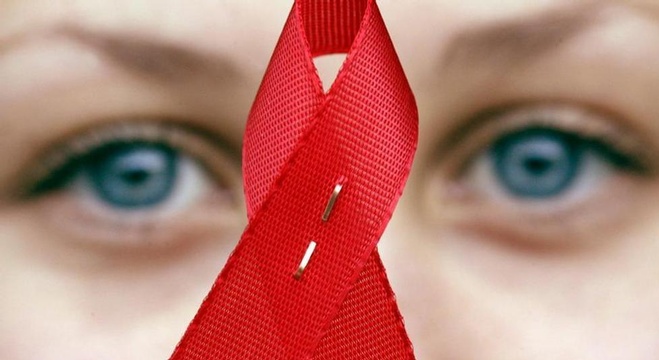 أبرز أسباب الوفاة بروسيا (الإيدز) 1.2 مليون مواطن مصاب