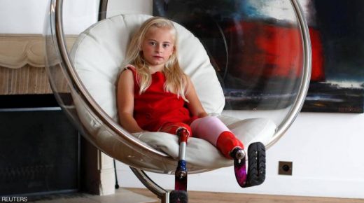 طفلة مبتورة ساقين ‘تصنع التاريخ’ في عالم الموضة