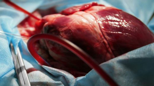 “الجمعية الفلسطينية لأمراض وجراحة القلب” تعلن بدء عملها في المحافظات الشمالية