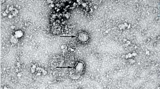 أول صورة لفيروس “كورونا”