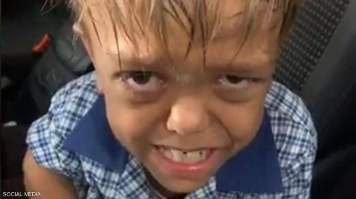 الطفل الأسترالي ضحية التنمر.. كيف تغيرت حياته بمقطع فيديو؟