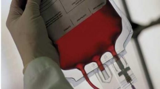 هل يمكن لعملية نقل دم جديد أن توقف تقدمنا في العمر؟