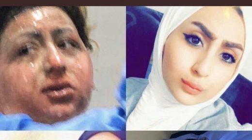 وفاة العراقية ملاك الزبيدي بعد أيام من حرقها نفسها بسبب خلافات عائلية