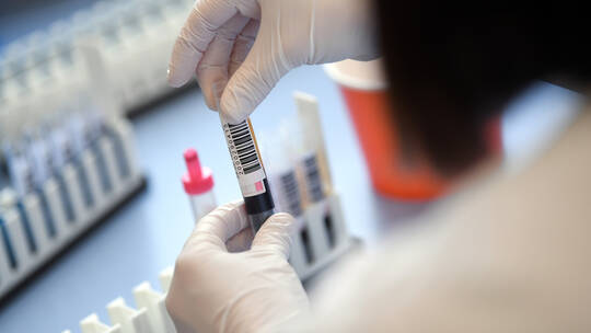 تركيا تبدأ استخدام “بلازما دم” أشخاص تعافوا من فيروس كورونا في علاج المصابين