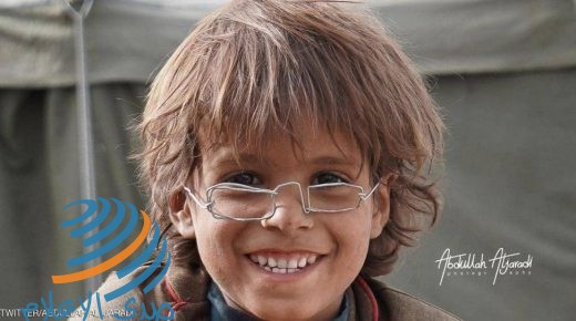 مزاد على “نظارة” طفل نازح يمني يحقق 2.5 مليون ريال