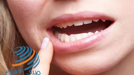 تعرف على طرق طبيعية وفعالة لعلاج تقرحات الفم