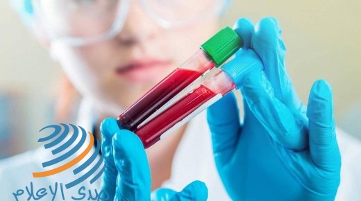 اكتشاف جديد لتطوير علاج أشرس أنواع سرطان الدم