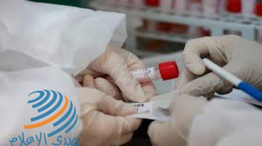 7 إصابات جديدة بفيروس “كورونا” في الأردن إحداها محلية