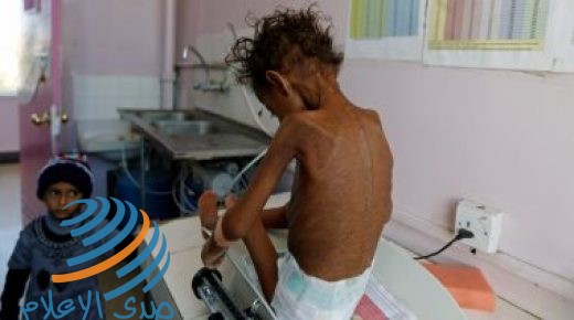 الأمم المتحدة تحذر من خطر مجاعة وشيكة في اليمن
