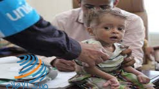 يونيسف: حياة ملايين الأطفال في خطر مع اقتراب اليمن من المجاعة