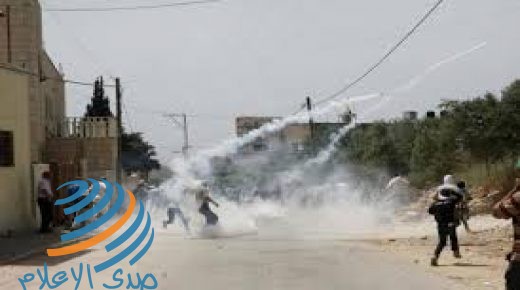إصابة 3 مواطنين بينهم مسعف بالرصاص بمواجهات مع الاحتلال في كفر قدوم