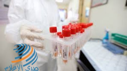 الصحة: 12 وفاة و928 إصابة جديدة بكورونا