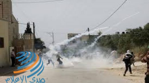 إصابة 18 مواطنا “بالمطاط” والعشرات بحالات الاختناق خلال قمع الاحتلال مسيرة كفر قدوم الأسبوعية