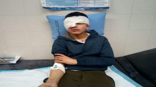 الخليل: الاحتلال يصيب طفلا في عينه ويتسبب له بفقدانها