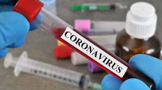 4 وفيات و1570 إصابة جديدة بفيروس “كورونا” و197 حالة تعافٍ