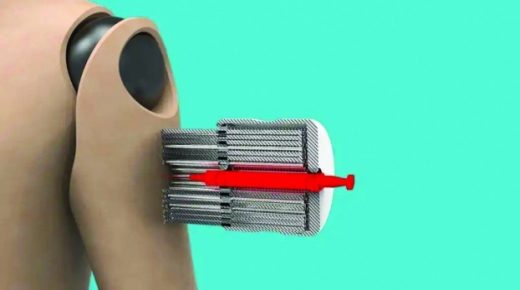 ابتكار يخفف الخوف من «رهاب الحقن»