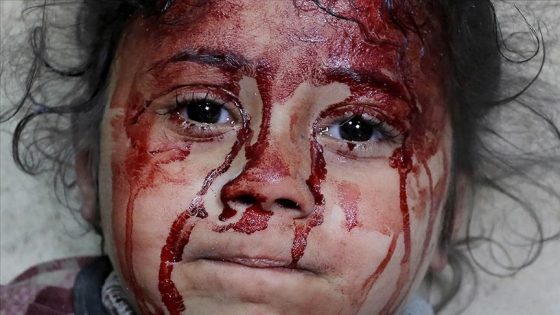 لازاريني: عدد قتلى أطفال غزة يفوق نظراءهم بحروب العالم آخر 4 سنوات