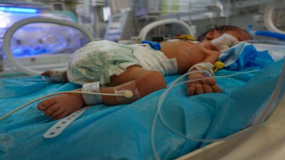 الصحة العالمية: ربع المصابين في العدوان على غزة بحاجة لتأهيل لسنوات مقبلة