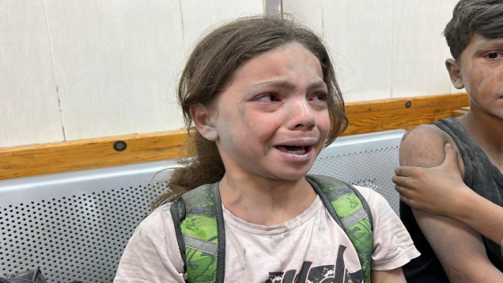 الأمم المتحدة: الكارثة الإنسانية بغزة في أسوأ حالاتها منذ بداية الحرب