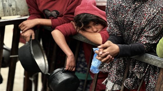 “الأونروا”: 66 ألف طفل في قطاع غزة يعانون سوء تغذية خطيرا