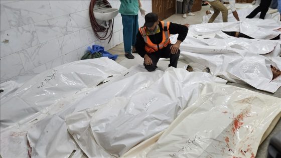 طبيب أسترالي: ضحايا مركز توزيع مساعدات برفح تلقوا رصاصات في الرأس والصدر