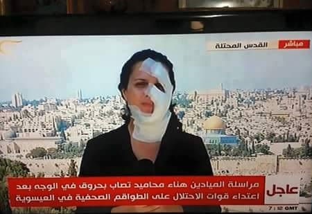 بعد اغلاق ملف التحقيق.. الصحفية محاميد تتابع ملف إصابتها